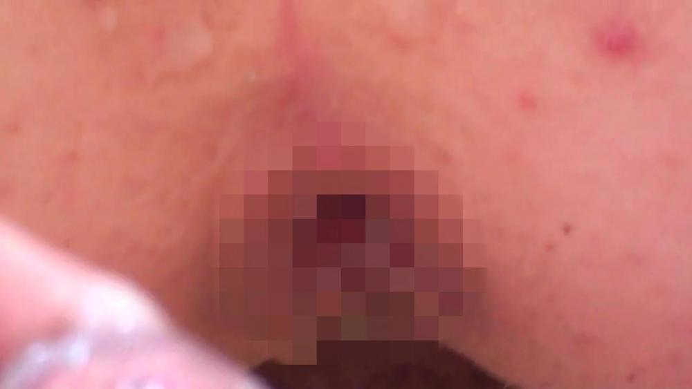 Arschloch auf-Sperma kommt