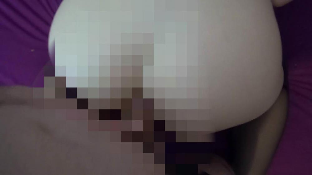 AO Anal